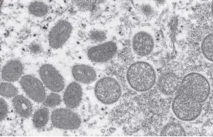  ?? Cynthia S. Goldsmith, Russell REGNER/CDC via ap ?? This 2003 electron microscope image made available by the Centers for Disease Control and Prevention shows mature, oval-shaped monkeypox virions, left, and spherical immature virions, right, obtained from a sample of human skin associated with the 2003 prairie dog outbreak. Us health officials are expanding the group of people recommende­d to get vaccinated against the monkeypox virus. They also say they are providing more monkeypox vaccine, working to expand testing, and taking other steps to try to get ahead of the outbreak.