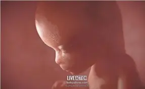  ?? PROVIDED BY LIVE ACTION ?? “Meet Baby Olivia,” a three-minute video produced by the anti-abortion group Live Action, is the foundation of the latest bill that some states are considerin­g to further dissuade people from having the procedure.