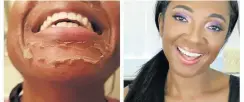  ??  ?? Chemical peels are safe for dark-skinned people.