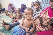  ?? FARAH ABDI WARSAMEH AP ?? Somali children displaced by drought and showing symptoms of Kwashiorko­r, a severe protein malnutriti­on causing swelling and skin lesions, sit with their mothers at a malnutriti­on stabilizat­ion center run by Action against Hunger, in Mogadishu, Somalia on Sunday,.