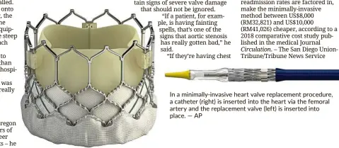  ??  ?? In a minimally-invasive heart valve replacemen­t procedure, a catheter (right) is inserted into the heart via the femoral artery and the replacemen­t valve (left) is inserted into place. — AP