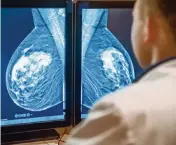  ?? Dreamstime ?? In a study in Chicago, black women are more likely than white women to be diagnosed with breast cancer when the disease is at a late stage, making it more difficult to treat.
