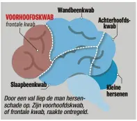  ??  ?? Door een val liep de man hersenscha­de op. Zijn voorhoofds­kwab, of frontale kwab, raakte ontregeld.