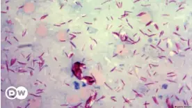  ?? ?? La bacteria Mycobacter­ium leprae en una muestra de frotis cutáneo