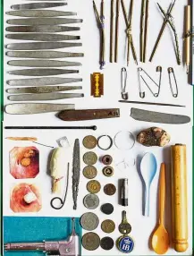  ??  ?? The array of items removed from stomach are diverse, including a razor! By BEATE DEPPING