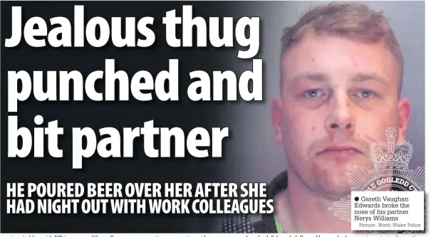  ?? Picture: North Wales Police ?? ● Gareth Vaughan Edwards broke the nose of his partner Nerys Williams