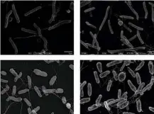  ?? Reprodução/“Nature Communicat­ions” ?? Antes (acima) e depois (abaixo) das mutações introduzid­as