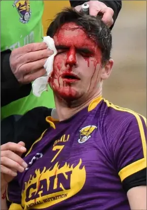  ??  ?? No gain without pain...defender Eanna Martin had to leave the fray to get treatment for this nasty cut over his right eye, sustained in the first-half of Saturday’s final.