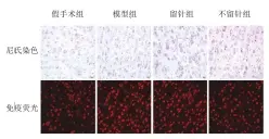  ??  ?? 图 4 各组大鼠皮层神经元损­伤情况（×400）