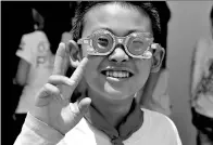  ??  ?? A boy in optometric treatment before preparing to wear glasses.