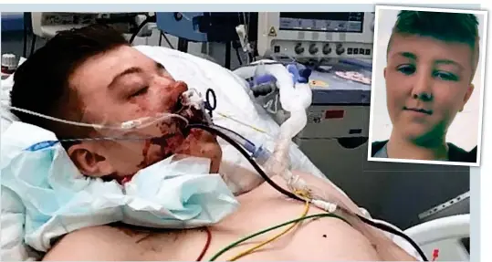  ??  ?? ‘Nothing more they could do’: The distressin­g picture of Reece Murphy, inset, on a life support machine in hospital
