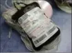  ?? MICHAEL CONROY, THE ASSOCIATED PRESS ?? On Friday the Food and Drug Administra­tion recommende­d that all U.S. blood banks start screening for the Zika virus.