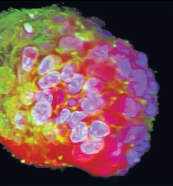  ??  ?? > ‘The research should eventually lead to faster identifica­tion of more effective drugs’ – a miniature tumour called an organoid captured in 3D using the new technology