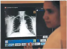  ?? FOTOS: ALEX PÉREZ ?? Las radiografí­as se ven en una moderna pantalla en el HEU.