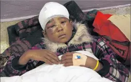  ??  ?? SABINA LAMA, 11, rests after an operation at the hospital. A resident of a nearby village said, “I heard on BBC radio about all the aid. Where is our aid?”