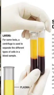  ??  ?? For some tests, a centrifuge is used to separate the different types of cells in a blood sample.
PLASMA WHITE BLOOD CELLS AND PLATELETS