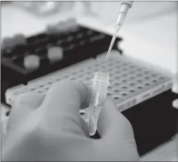  ?? Al Seib
/ Los Angelestim­es /TNS ?? A lab specialist manually pipettes a mix for coronaviru­s testing.