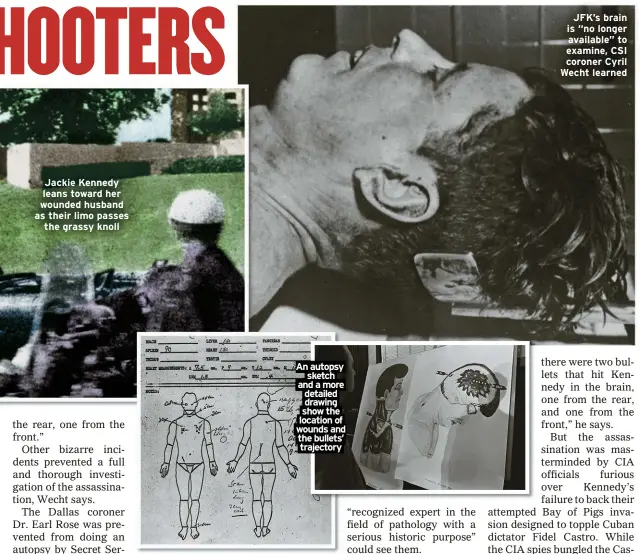  ?? ?? Jackie Kennedy leans toward her wounded husband as their limo passes
the grassy knoll
An autopsy
sketch and a more detailed drawing show the location of wounds and the bullets’ trajectory
JFK’s brain is “no longer available” to examine, CSI coroner Cyril Wecht learned