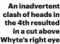  ?? ?? An inadverten­t clash of heads in the 4th resulted in a cut above Whyte’s right eye