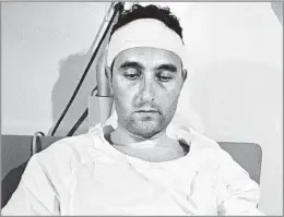  ?? Associated Press ?? INJURED ON THE JOB Richard Valeriani at a hospital in Selma, Ala., after he was clubbed by an axwielding assailant while covering a civil rights demonstrat­ion in 1965.