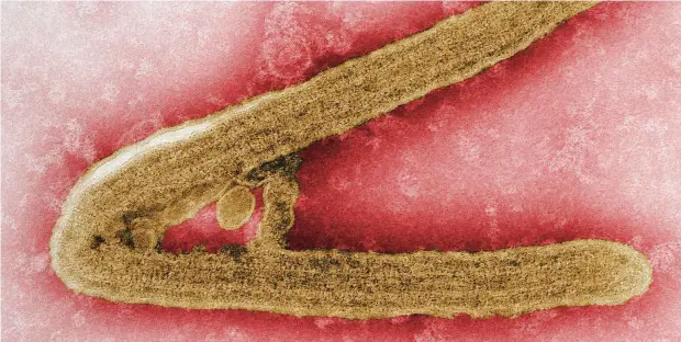  ?? Foto: dpa/CDC ?? Marburg-Virus aus einer Zellkultur unter dem Elektronen­mikroskop. Der zur Familie der Filoviren gehörende Erreger wurde nach einem Ausbruch in Marburg vor 50 Jahren entdeckt.