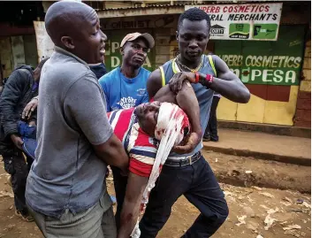  ?? PHOTO AFP ?? Un homme a subi de graves blessures, hier, dans le quartier populaire de Kondele, à Kisumu, lors de violents heurts avec les forces de l’ordre.