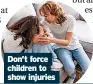  ?? ?? Don’t force children to show injuries