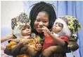  ?? BAMBINO GESU HOSPITAL VIA AP ?? Ermine Bangalo holds her twins, Ervina and Prefina.