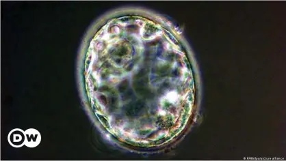  ??  ?? This is a real human blastocyst. Researcher­s have now created similar structures or "blastoids".