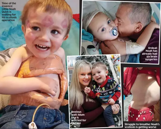  ?? ?? Time of the essence: Little Noah Quish is waiting for his scoliosis operation