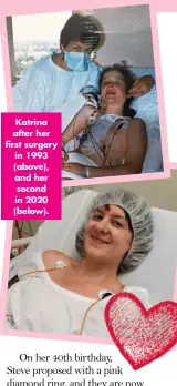  ?? ?? Katrina after her first surgery in 1993 (above), and her second in 2020 (below).