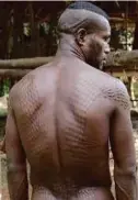  ??  ?? Lelaki di perkampung­an Parambei menunjukka­n bahagian belakang yang dicacah menyerupai sisik buaya.
