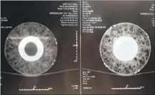  ??  ?? Side-by-side CAT scan images. The 1945 World Series ball on the left and Paul Konerko’s grand slam ball from the White Sox 2005 World Series.