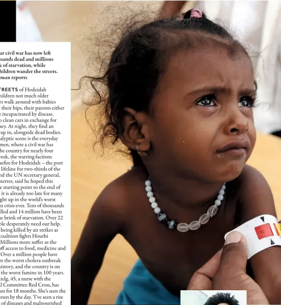  ??  ?? Clockwise a child receives from treatment; above: Amal Hussain’s shocking picture; Beilqes, who fears for her family; the Red Cross’s Rose Ochielg