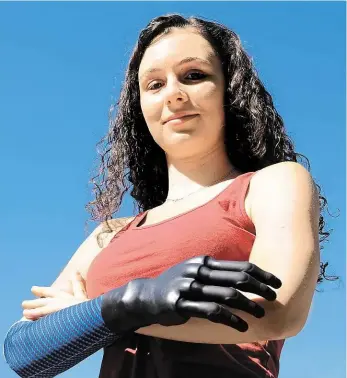  ?? Foto: Jan Smekal, MAFRA ?? Bionická ruka Kamila Šabršulová žije od narození bez pravého předloktí. Teď se učí používat bionickou protézu a vlastními svaly ovládat umělé prsty. I když to není snadné, je šťastná.