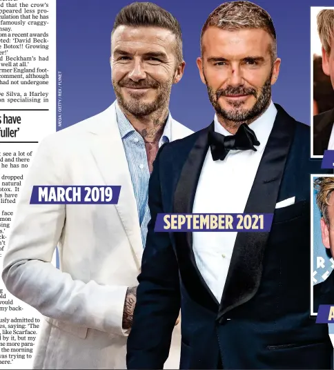  ?? ?? LOSING HIS LINES: David Beckham’s wrinkles look smoother – the same effect that chef Gordon Ramsay achieved with fillers