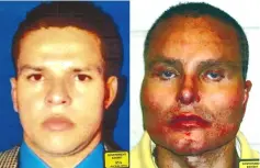  ??  ?? This combinatio­n of undated handout photograph­s shows a before (left) and after plastic surgery picture of Juan Carlos ‘Chupeta’ Ramirez Abadia shown to the jury during the El Chapo trial in Brooklyn federal court and filed as evidence by the US government. — AFP photo