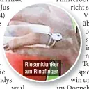  ??  ?? Riesenklun­ker am Ringfinger