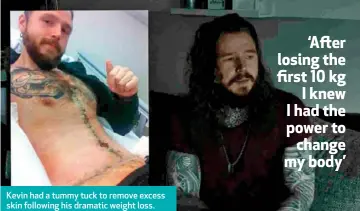  ??  ?? Kevin had a tummy tuck to remove excess skin following his dramatic weight loss. He covered the surgery scars with tattoos.