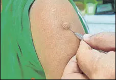  ?? SHUTTERSTO­CK ?? Currently 97% of 26 million children born in India receive the BCG vaccine free of cost.