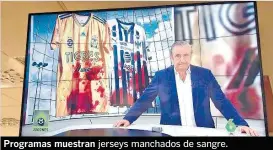  ??  ?? Programas muestran jerseys manchados de sangre.