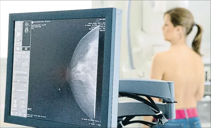  ?? MEDIA FOR MEDICAL / GETTY ?? Las mamografía­s periódicas facilitan el diagnóstic­o precoz y reducen la probabilid­ad de que el cáncer evolucione hacia las metástasis