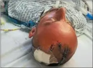  ?? FAMILY PHOTO ?? Steven Augustine is shown is his hospital bed, with surgical staples in his head, after the assault.
