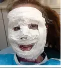  ??  ?? NOV 4, 2013: Katie’s face is covered in plaster of Paris to create a mould for her plastic mask