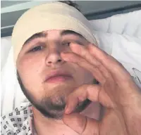  ?? The Corsa – also suffered face and hand injuries when another offender smashed the car window ?? ●●Attack victim Matthew Hayden was left with a fractured skull and needed emergency surgery for a bleed on the brain