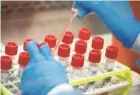  ?? JOHN MINCHILLO/AP ?? A technician prepares COVID-19 coronaviru­s patient samples for testing at a laboratory in Long Island, N.Y.