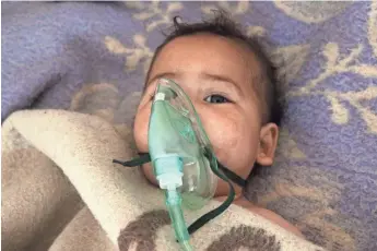  ?? MOHAMED AL-BAKOUR, AFP/GETTY IMAGES ?? A child receives treatment Tuesday after a suspected toxic gas attack in Khan Sheikhoun, a rebel-held town in the Idlib province in northern Syria. Scores of civilians and children died.