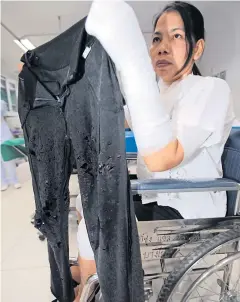  ?? CHANAT KATANYU ?? Ubonrat Ounkhamrue­n, one of five people injured by a chemical spill, shows her damaged clothes. She also has burns to her legs and left arm. The spill was caused when a bus knocked over a bottle of caustic soda on Phetkasem Road, causing the bottle to...