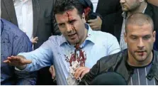  ?? PHOTO: EPA ?? HIT: Zoran Zaev, the bloodied leader of Social Democratic Union of Macedonia, tries to leave the Parliament.