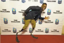  ?? Greg Doherty / Getty Images 2016 ?? U.S. paralympic athlete Blake Leeper, at a 2016 charity event, is contesting a ruling that says his running blades are too long.